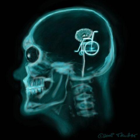 Cartoon: X-ray (medium) by Mandor tagged ray,head,skull